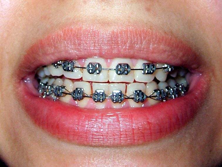 images/ortodonta.jpg6ab54.jpg